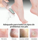 Lixador de Pé Elétrico Portátil | Remoção de Calos Eficiente